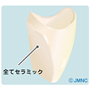 ジルコニアオールセラミッククラウン